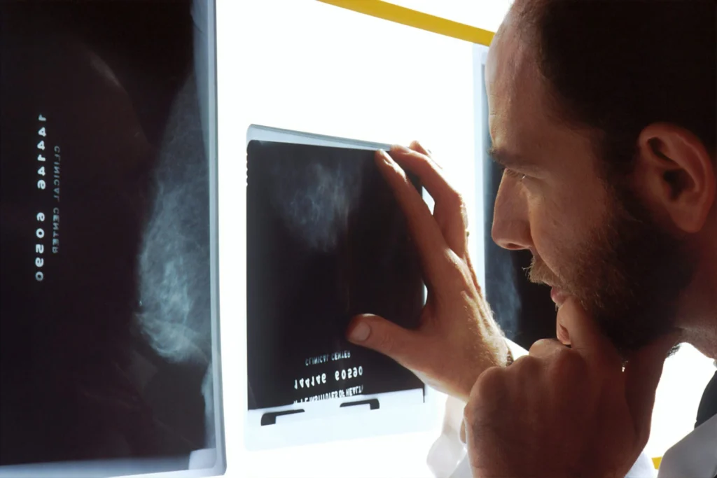 Læge undersøger et røntgenbillede/mammografiscanning i lyskassen