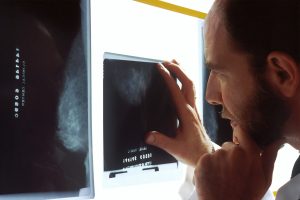 Læge undersøger et røntgenbillede/mammografiscanning i lyskassen
